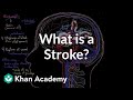 Understanding Strokes: Causes, Types, and Effects