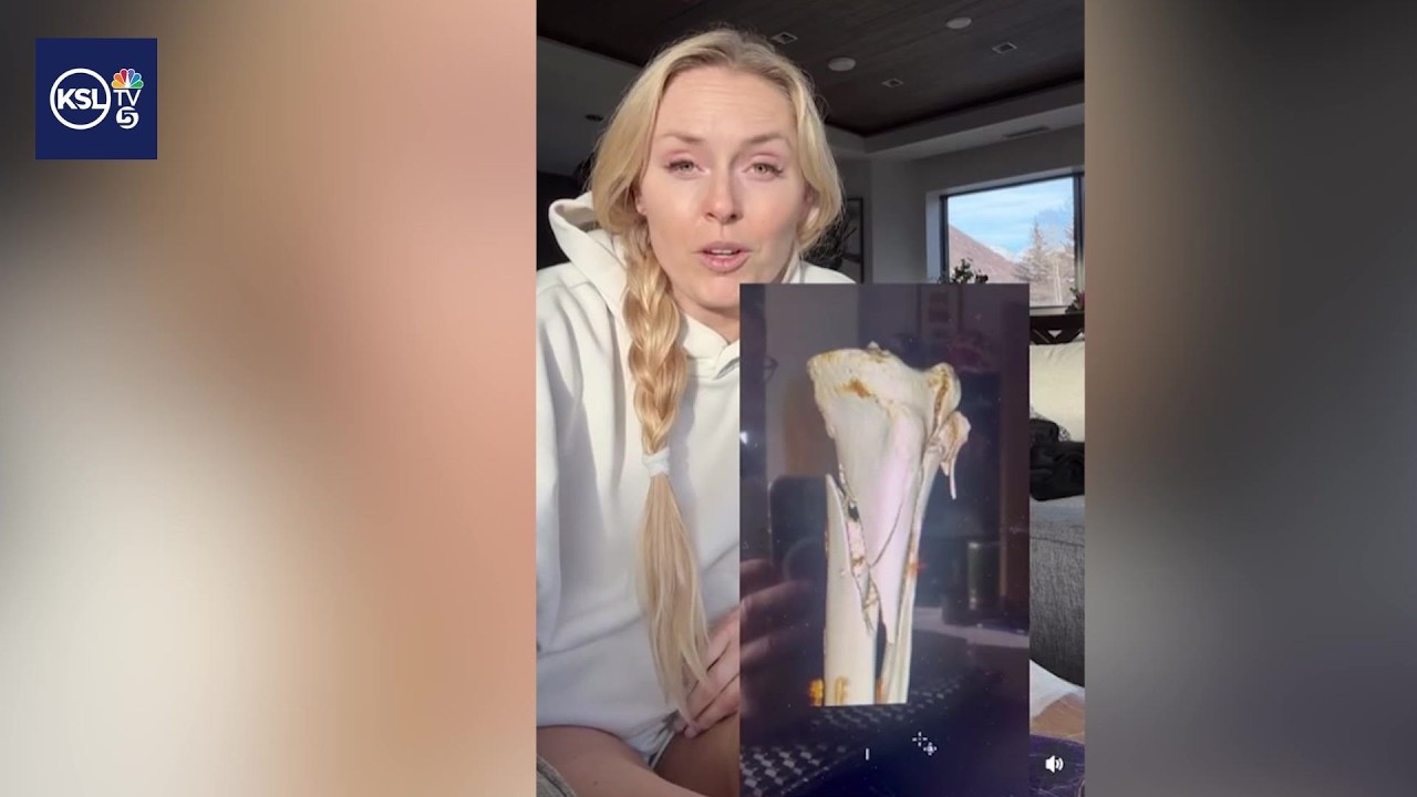 Lindsey Vonn's recovery from alpine ski crash