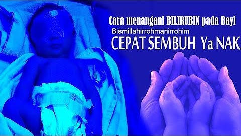Mengatasi Bilirubin pada Bayi saat baru Lahir