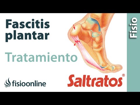 Fascitis plantar - Ejercicios, masajes y consejos para su tratamiento