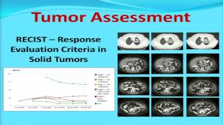 ViSion for Radiology Structured Reporting [University of Texas MD Anderson Cancer Center] App Demo