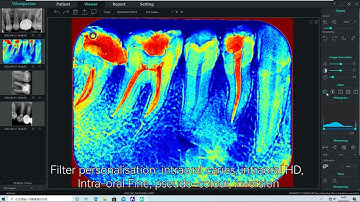 Woodpecker - i-Sensor - Installation