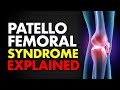 Patellofemoral Syndrome Explained