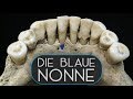 Die blaue Nonne oder Lapislazuli im Zahnstein