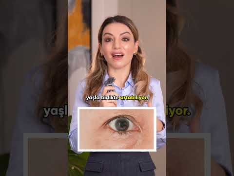 Göz Çevresi Sorunları