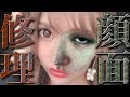 【 重大発表 】 整形サイボーグ 、”また” 整形 します。【 二重幅修正 】