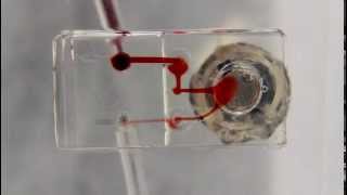 Download lagu Low cost Micropump Low cost Micropump
