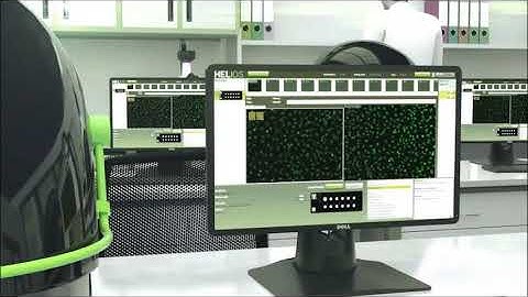 HELIOS - Fully automated IFA analyser