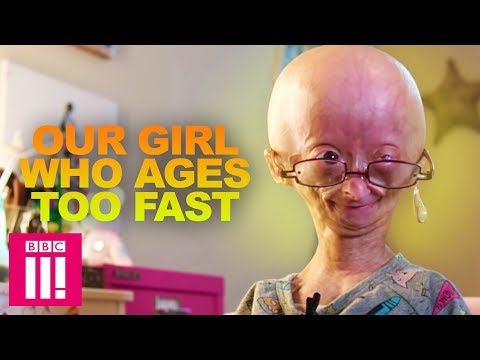 Our Girl Who Ages Too Fast: Adalia Rose | Living Differently