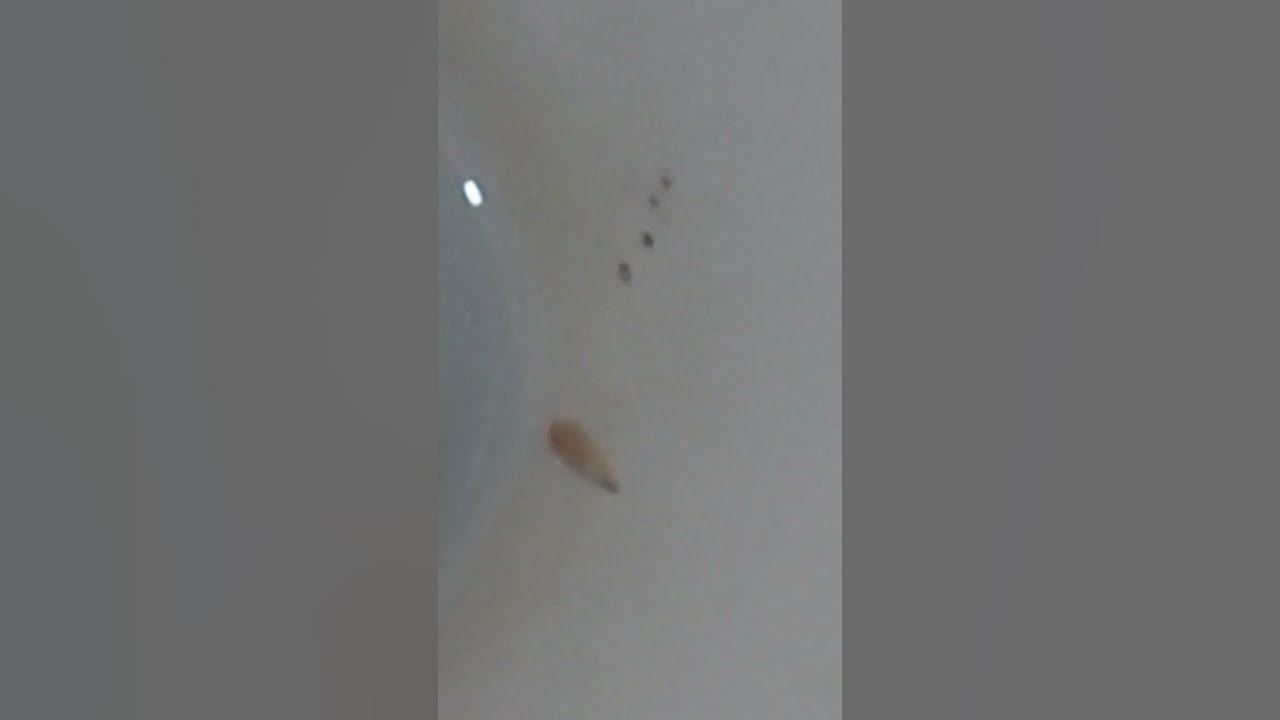 TatianaBerkoh Horrid discovery of MAGGOTS😱in landlord Abdul Yeboah's