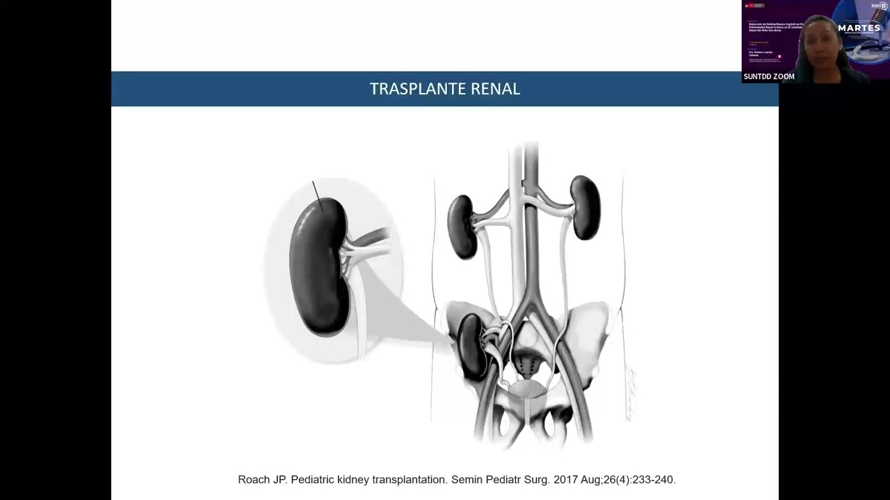 Detección de Polimorfismos Cyp3a5 en Pacientes con Enfermedad Renal Crónica en el Instituto Nacional de Salud del Niño San Borja