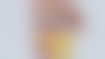 Robotic Radical Left Nephrectomy with IVC Level III Thrombectomy