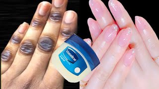Hand whitening secret home remedies | Hand whitening cream | Manicure at home