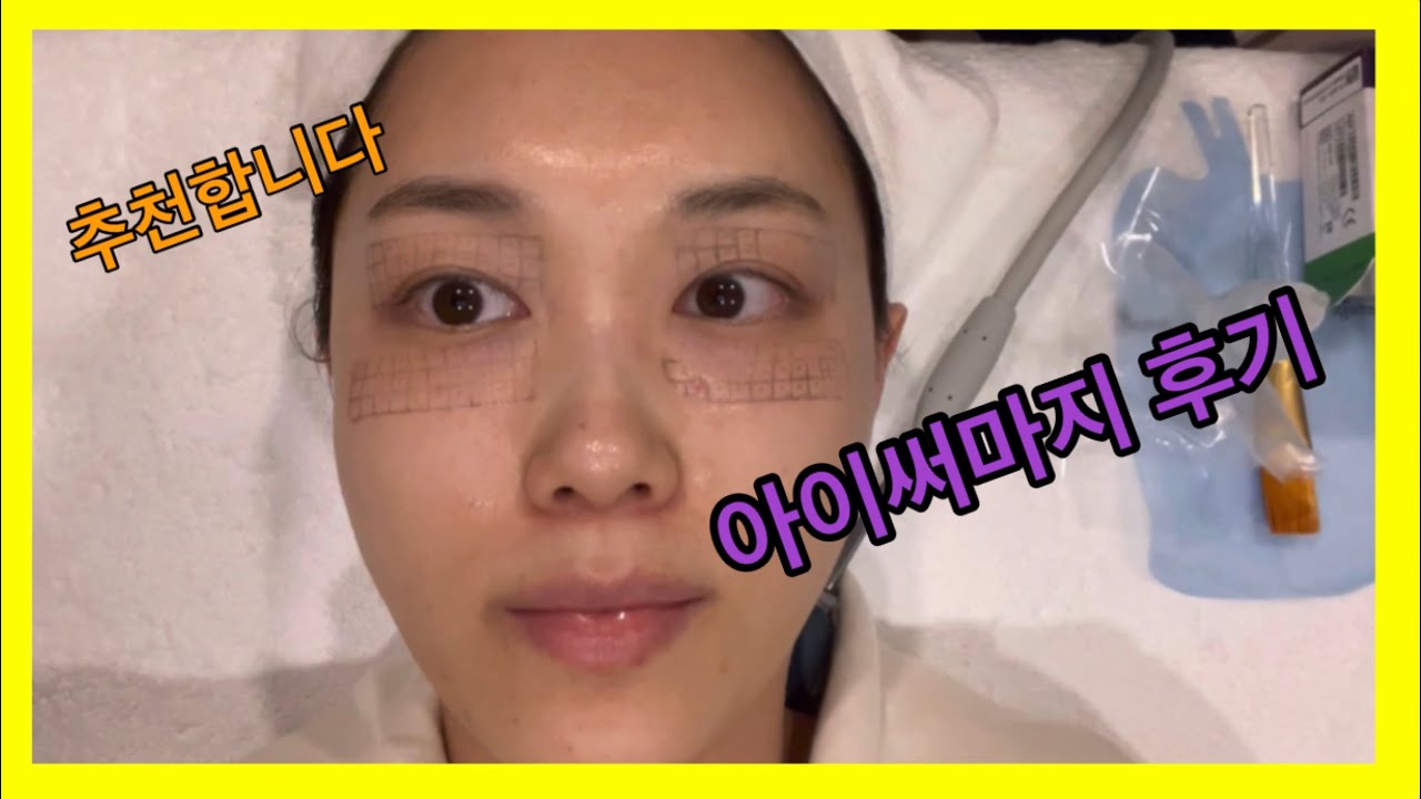 아이서마지 리뷰 조건에 맞는 방향으로 8