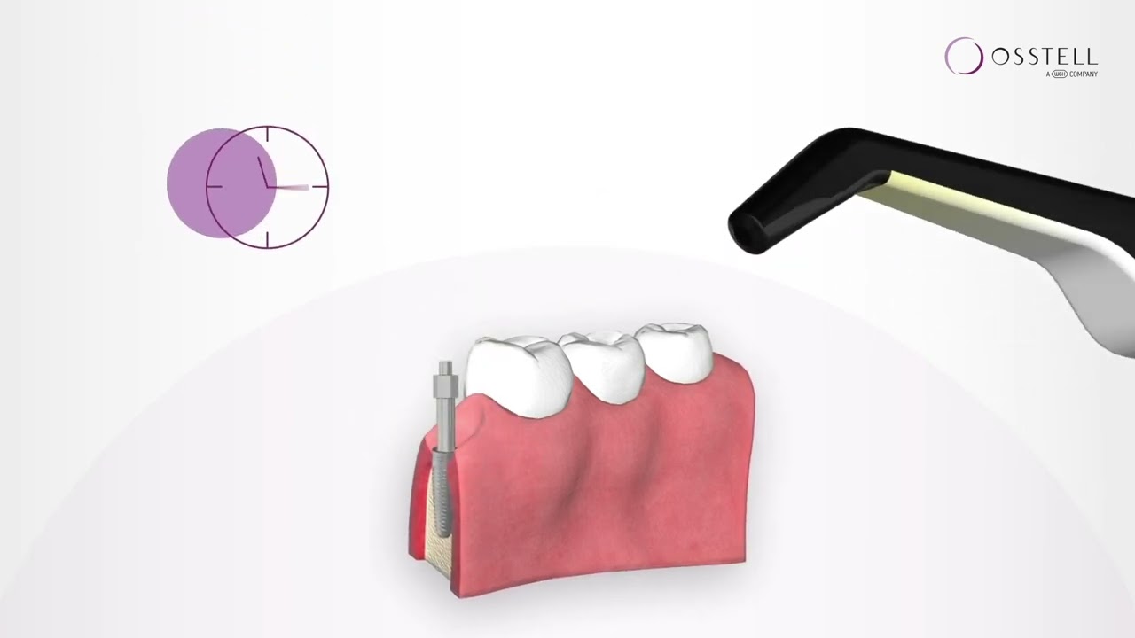 patientpop 3d health explainer-