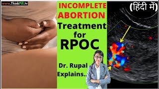 (Incomplete Abortion) Dr. Plz !!! Give Treatment for RPOC (Hindi) #LadiesHealth