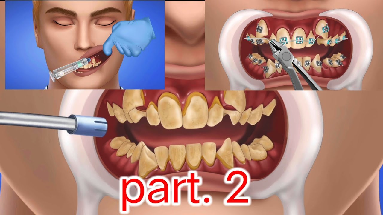 ASMR teeth clipping treatmentteeth clipping treatment ASMR videos