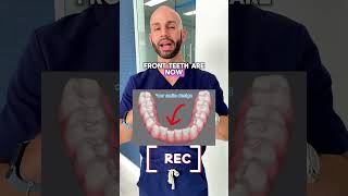 Adult Invisalign Transformation in Just 6 Months! Profile