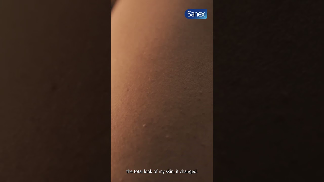 Sanex - Tanusta Skin Stories  #skinstories