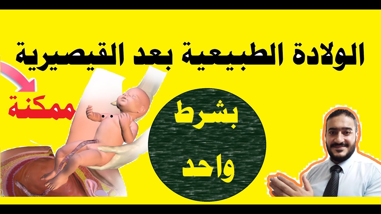 هل ممكن إجراء ولادة طبيعية بعد عملية قصيرية سابقة ؟؟ الإجابة نعم بشرط واحد تعرفي عليه في هذا الفيديو