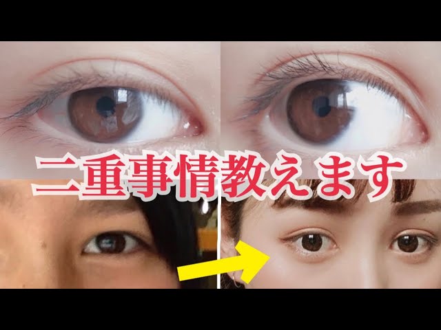 アイテープで簡単 バレない二重の広げ方 癖付け Youtube