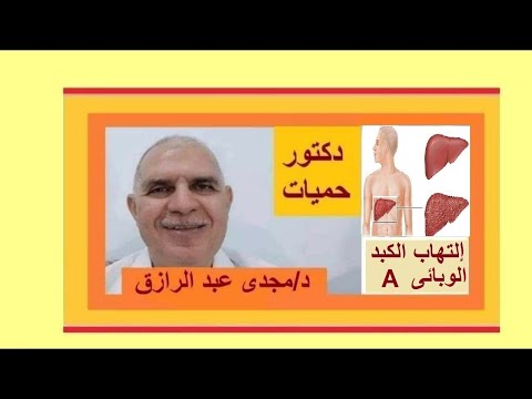 إلتهاب الكبد الوبائى أ الفيروسى أعراضه ومضاعفاته أبو صفار HEPATITIS A