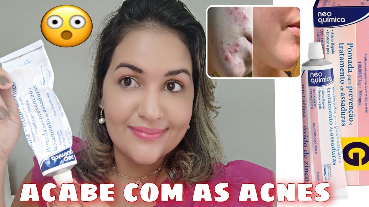 Oxido De Zinco No Rosto 16 Dicas De Como Melhorar A Pele Do Rosto
