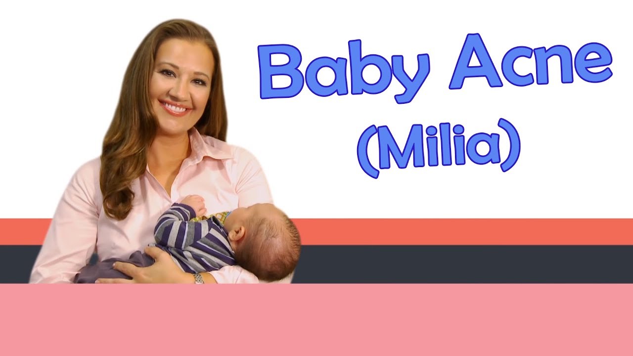 BABY ACNE (MILIA) | Baby Care with Jenni June