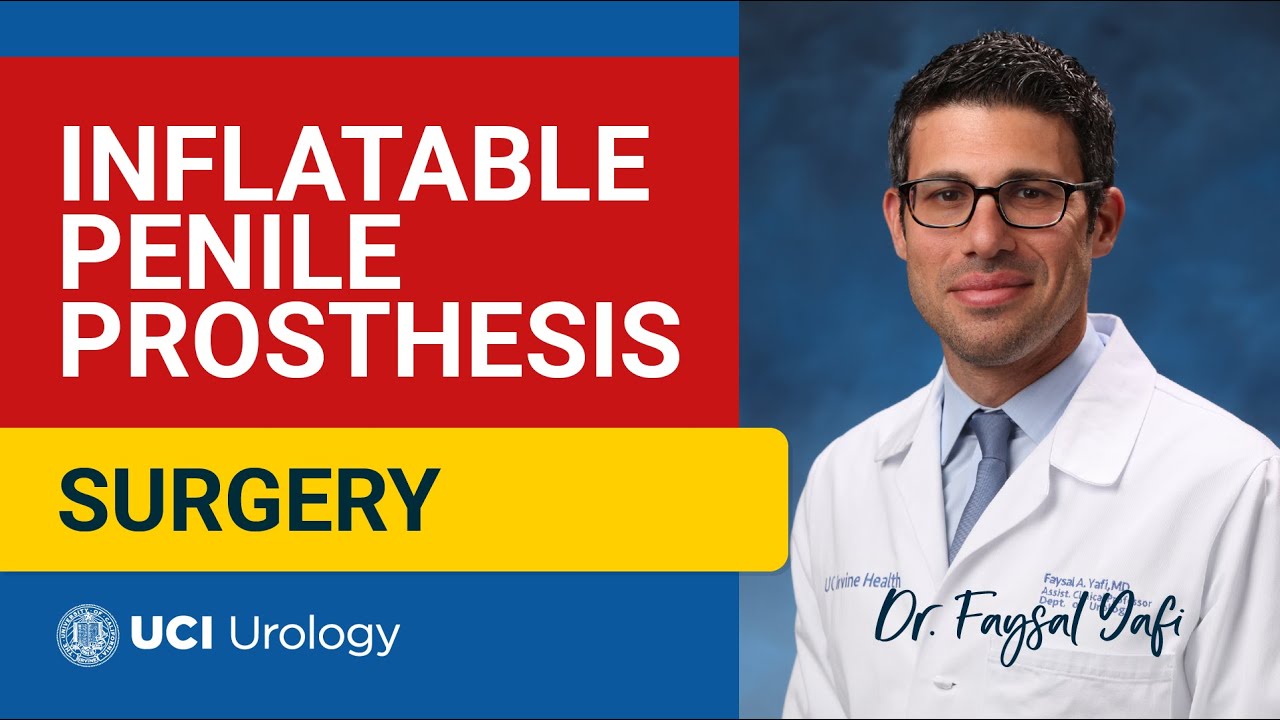 Inflatable Penile Prosthesis Surgery by Dr. Faysal A. Yafi - UCI Department of Urology