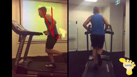 Enhance Gait analysis: increased trunk flexion