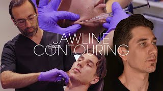 Jawline Contouring Microcannula Injection Technique with Restylane Defyne | Dr. Kian Karimi