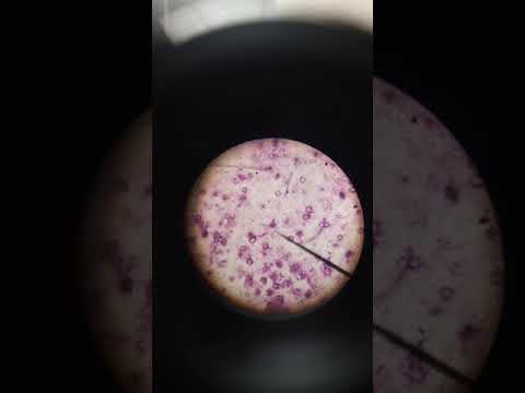 Video: Mikroskop apa yang digunakan untuk melihat amuba?