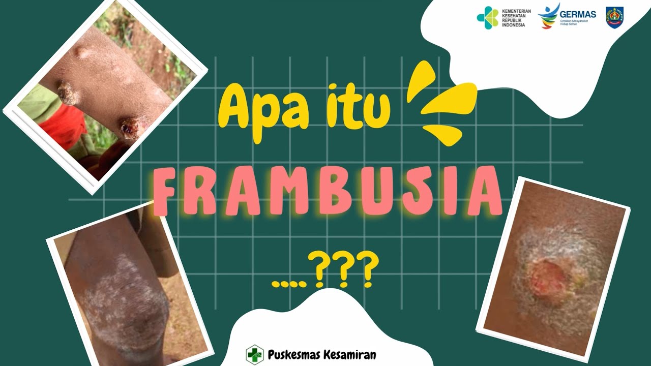 Puskesmas Itu Tipe Apa