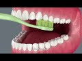 What Happens If You Brush or Floss Too Hard