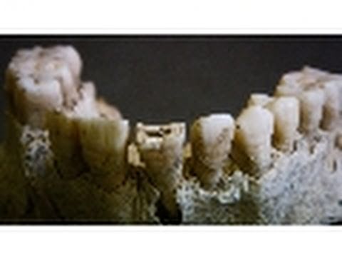 Bloody Battle Bones | National Geographic
