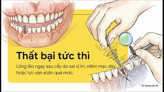 Biến chứng mini-implant — và cách xử trí | ANH & EM