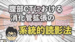 腹部CTにおける消化管拡張の系統的読影法