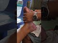 Reflexology massage with akosibopet