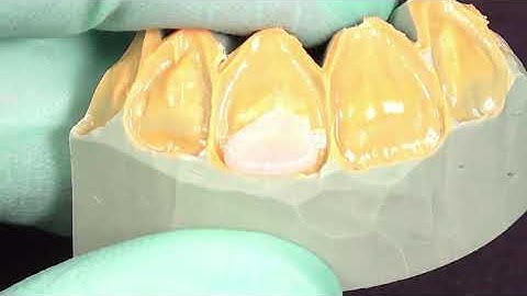 Zeta - The alphabet_kit