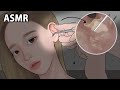 ASMR 팅글 쩌는 귀청소 애니메이션! 왕건이 뽑는 귀내시경 애니메이션 / 루루팡