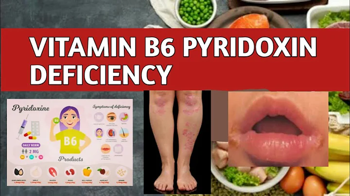 Vitamin B6 Pyridoxin Deficiency Food Sources, Causes, Symptoms, Diagnosis, & Treatment
