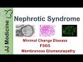 Nephrotic Syndrome | Clinical Presentation, Causes and Treatment