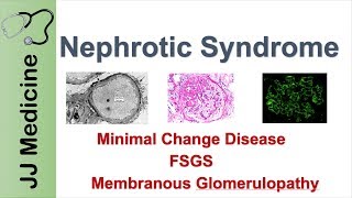 Nephrotic Syndrome | Clinical Presentation, Causes and Treatment