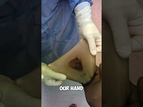 How to put gloves on for surgery! #shorts
