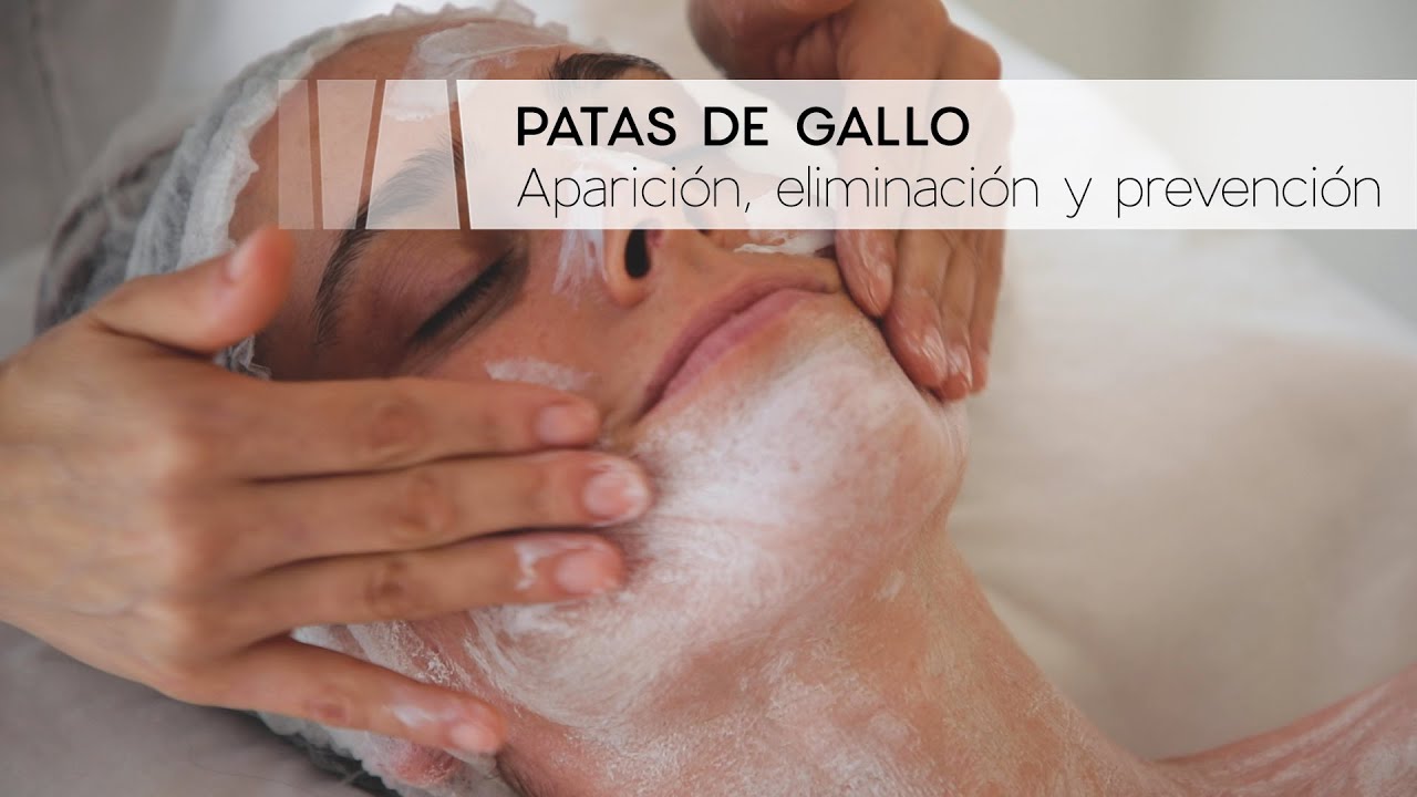 Pata De Camello Porque Se Forma