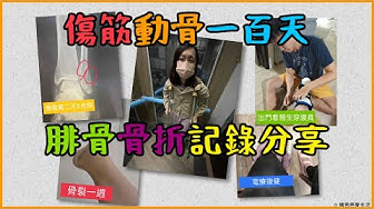 骨折 Youtube 骨折 Youtube