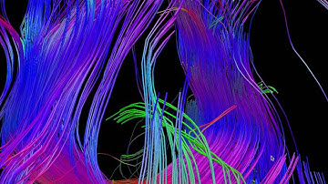 Diffusion Tensor Tractography DTI MRI 5 - William Edward Hahn