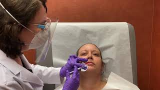 Lip injections Dr Rebecca Baxt Paramus N J