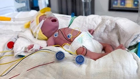 Nieuwe uitvinding redt pasgeboren baby