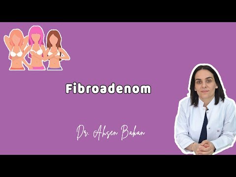 Video: Je u fibroadenomu nutná biopsie?